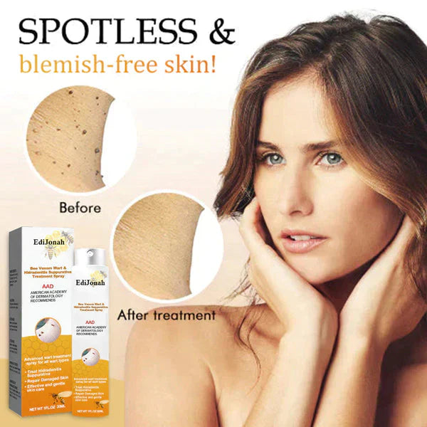 SkinPure | Wart & Skin Tag Spray – Fast-Acting, Precision Nozzle