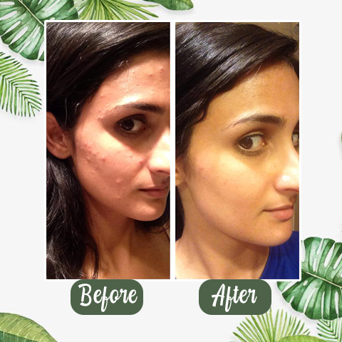 Lumière | Deep Cleansing Mask – Radiant Complexion Enhancer 5