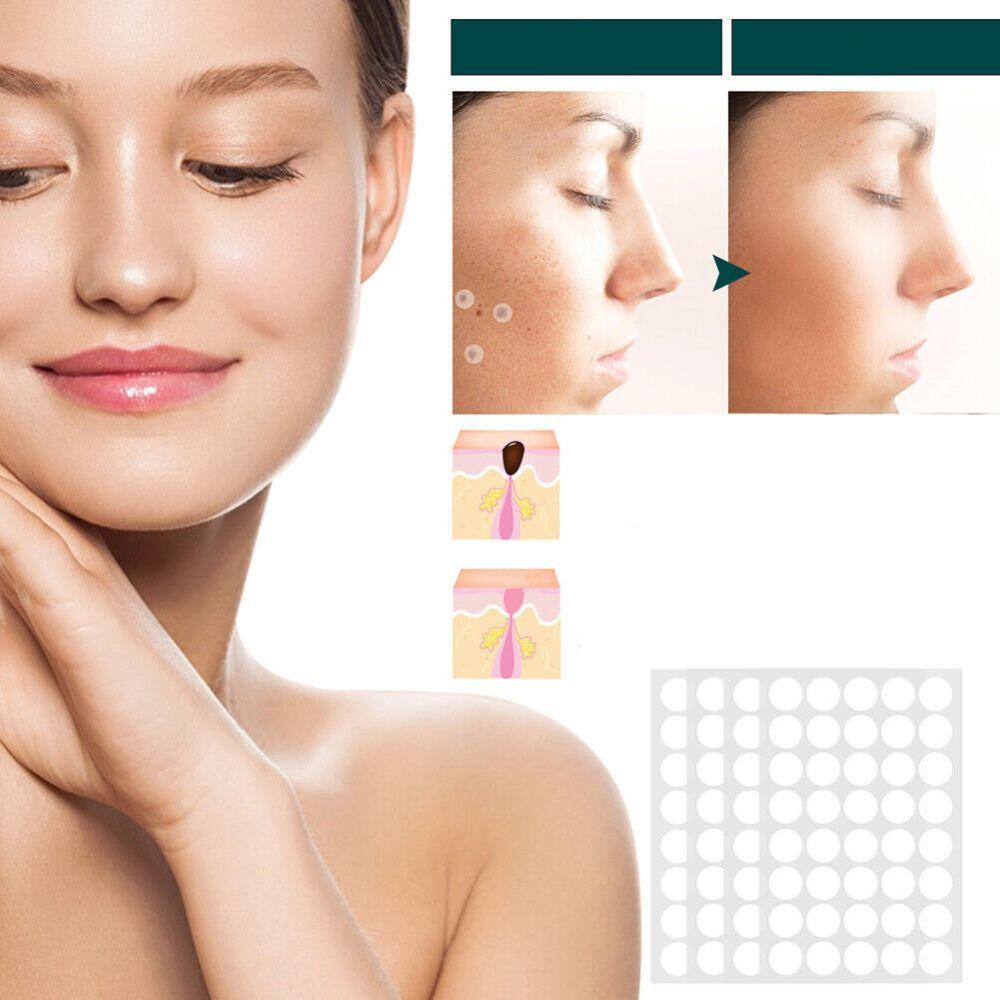 ClearDerm | Wart Removal Strips – Safe & Comfortable for All Skin
