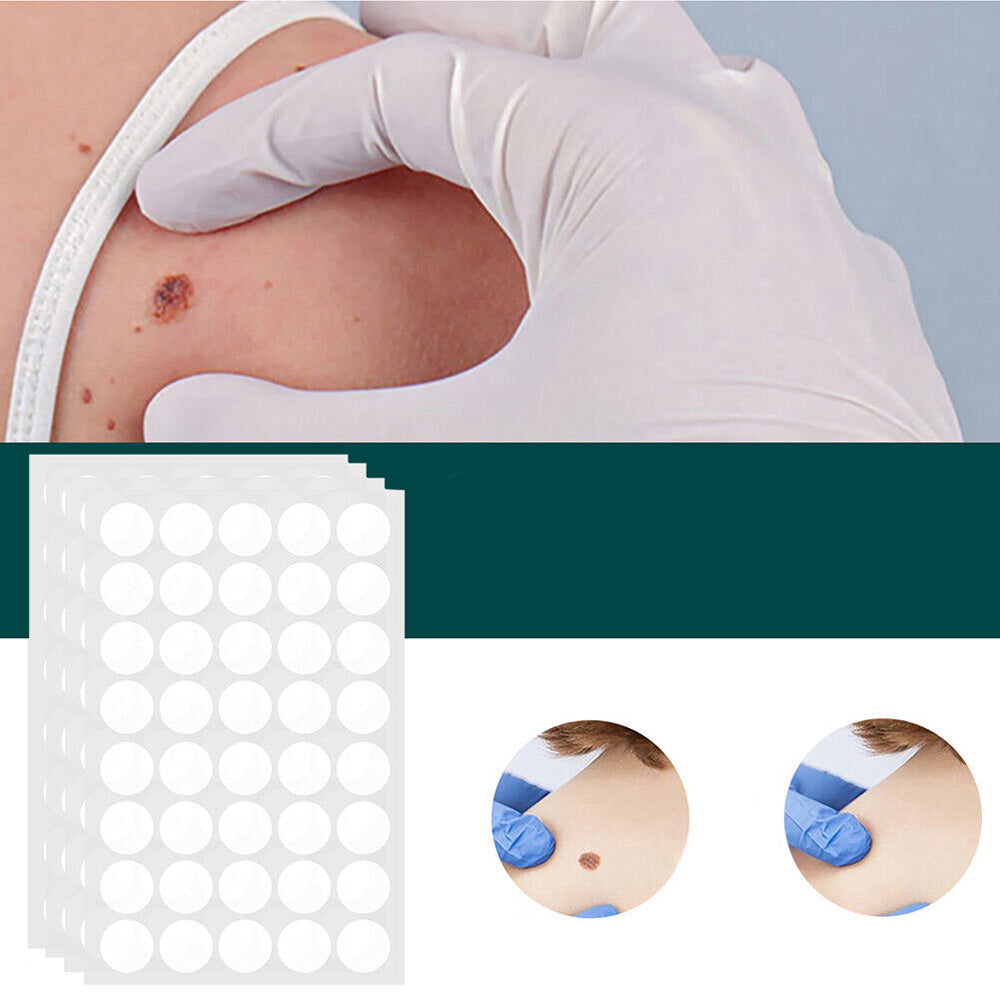 ClearDerm | Wart Removal Strips – Safe & Comfortable for All Skin