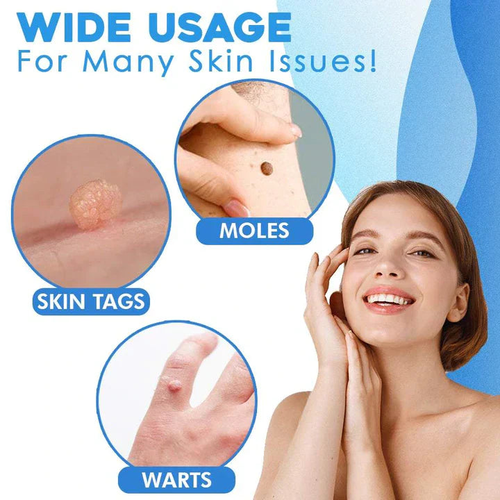 Bellezza | Skin Tag Removal Kit – Effortless Skin Perfection 4