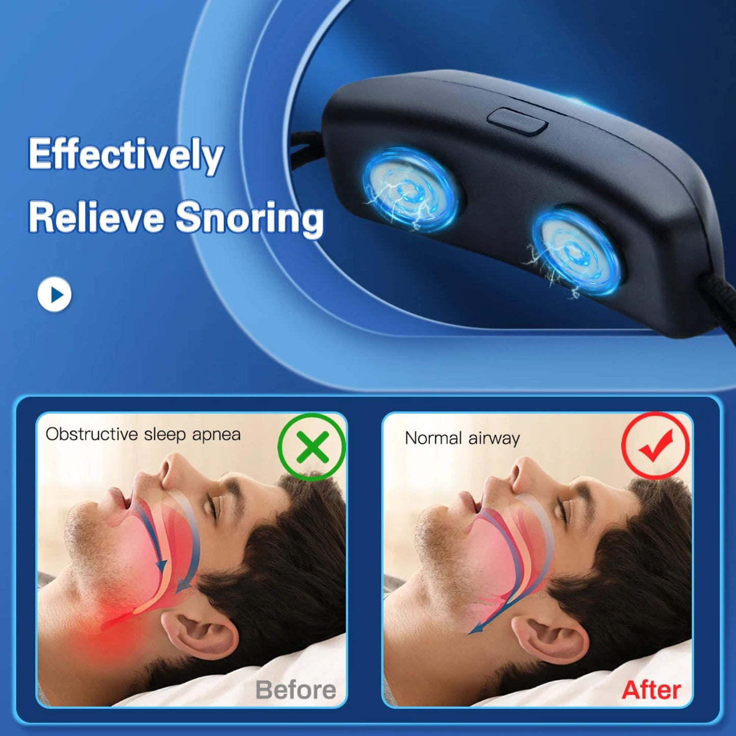 Hypnos | Effective anti-snoring stop device chin strap