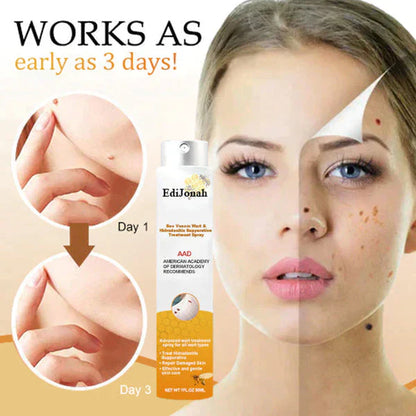 SkinPure | Wart & Skin Tag Spray – Fast-Acting, Precision Nozzle