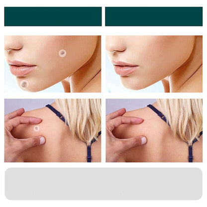 ClearDerm | Wart Removal Strips – Safe & Comfortable for All Skin