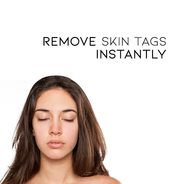SkinPure | Wart & Skin Tag Spray – Fast-Acting, Precision Nozzle