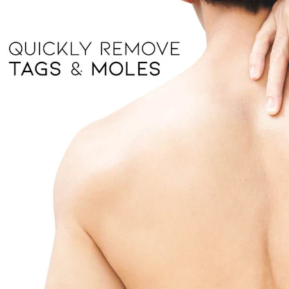 SkinPure | Wart & Skin Tag Spray – Fast-Acting, Precision Nozzle